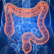 Irritable Bowel Syndrome related image